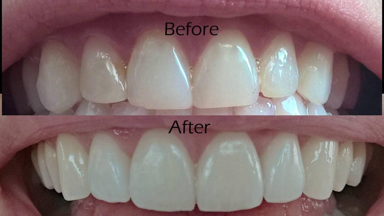 Dental Clinics Offering Payment Plans  A Lifesaver